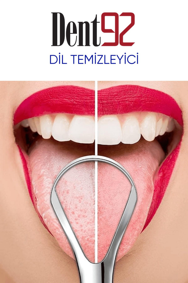 Dent92 Paslanmaz Çelik Dil Temizleyici